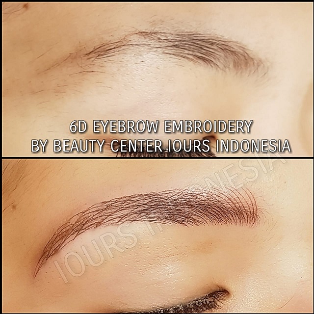 Beauty Treatment